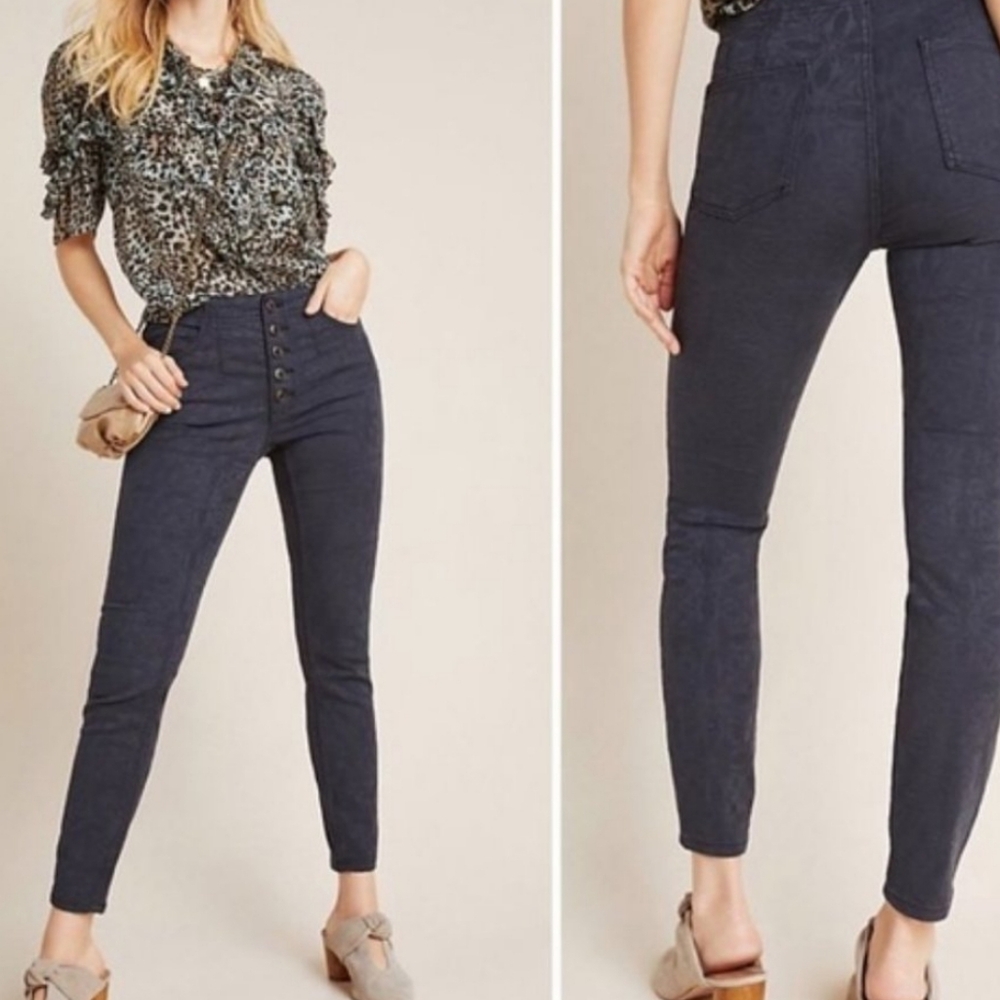 Pilcro Black Jacquard Skinny Jeans